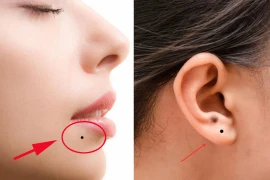 Có 7 nốt ruồi này chứng tỏ bạn số phú quý sung túc cả đời