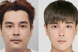 Khi nam giới cũng nâng mũi, cắt mí