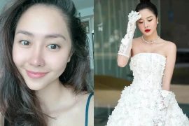 Diễn viên Tường Vi hậu trầm cảm vì 'dao kéo' hỏng