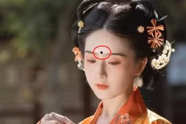 Mặt có 4 nốt ruồi này sẽ thu hút kẻ xấu, hủy vận may 