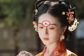 Mặt có 4 nốt ruồi này sẽ thu hút kẻ xấu, hủy vận may 