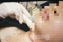 Cảnh sát thông tin vụ cô gái trẻ báo án bị cắt cổ, cướp tài sản ở Bình Dương