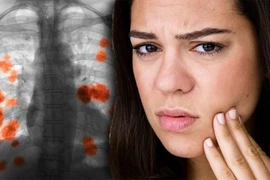 Dấu hiệu lộ trên mặt của ung thư phổi nhưng ít người biết