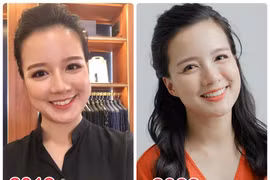 Nữ MC nổi tiếng "lột xác" sau 2 năm niềng răng