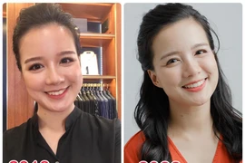 Nữ MC nổi tiếng "lột xác" sau 2 năm niềng răng