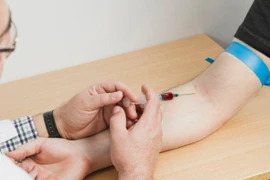 Lợi ích không ngờ từ việc hiến máu tình nguyện