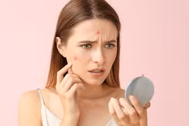 6 thực phẩm khiến làn da của bạn xấu đi