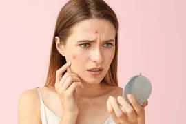 6 thực phẩm khiến làn da của bạn xấu đi