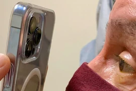 Bác sĩ dùng chiếc iPhone 13 Pro để khám mắt cho bệnh nhân