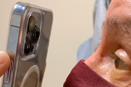 Bác sĩ dùng chiếc iPhone 13 Pro để khám mắt cho bệnh nhân