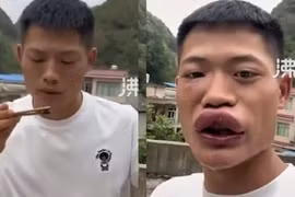 TikToker Trung Quốc bị cấm cửa vì clip ăn ong bắp cày