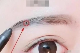 Phụ nữ có năm nốt ruồi thì giàu to, cuộc sống sung túc