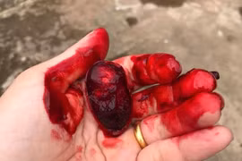 Quả dại kỳ lạ ở Việt Nam: Nhựa chảy đỏ tươi như máu người