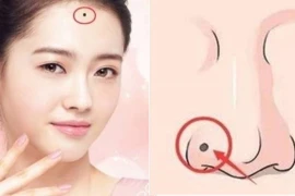 Trên mặt có 3 nốt ruồi ảnh hưởng đến phú quý, cả đời nghèo khó