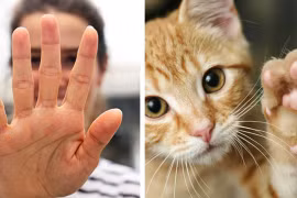 Tại sao con người có 5 ngón tay không phải 4 hay 6 ngón?