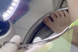 Bé gái 4 tuổi bị viêm vùng kín, giật mình phát hiện thủ phạm