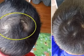 Nhìn xoáy tóc trên đầu đoán tính cách, vận mệnh của con