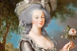 Thực hư căn bệnh khiến tóc đột nhiên bạc trắng