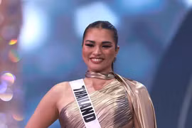 “Hoa hậu khủng long” gây ngỡ ngàng vì "lột xác" thon gọn