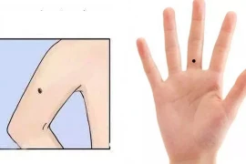 Điểm danh nốt ruồi trên tay tốt hay xấu