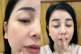 Cát Phượng "dao kéo" sau chia tay Kiều Minh Tuấn?