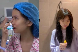 Nữ TikToker 1,3 triệu follow hé lộ quá trình phẫu thuật thẩm mỹ