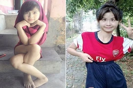 Chẳng cần gợi cảm, cô gái chân khoèo vẫn dẫn đầu Miss Teen