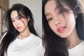 Đôi môi hiện tại của nàng WAGs Doãn Hải My giờ ra sao?