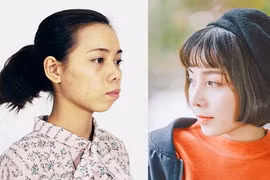 Bị chê "xấu như vượn", cô gái Thái Nguyên quyết phẫu thuật