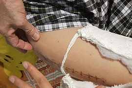 Bộ GD-ĐT: Xử nghiêm Hiệu trưởng trường Nam Trung Yên nếu sai phạm