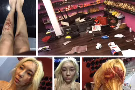 Sự thật đau lòng đằng sau ảnh bị bạo hành của nữ DJ nổi tiếng