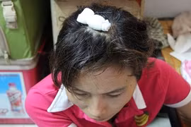 Nạn nhân kéo lê: "Tôi mất ngủ vì thông tin chăn dắt ăn xin"