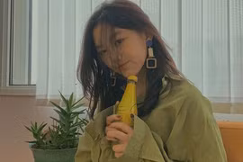 Cô gái bị hở hàm ếch thần thái ngời ngời, hóa ra thừa hưởng gen từ người "này"