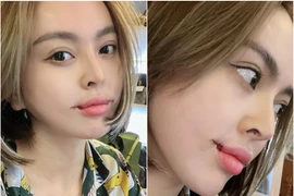 Sửa lại miệng, Trang Nemo lên sóng khiến netizen phát hoảng