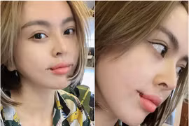 Sửa lại miệng, Trang Nemo lên sóng khiến netizen phát hoảng