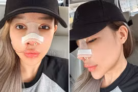 "Hot girl ngực khung" Ngân 98 bị gièm pha càng sửa càng xấu