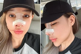 "Hot girl ngực khung" Ngân 98 bị gièm pha càng sửa càng xấu