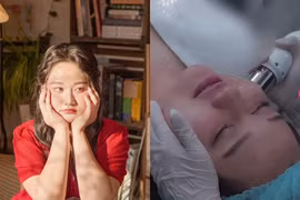 Trúc Anh (Mắt Biếc) hậu nâng cơ mặt, nhan sắc ra sao?