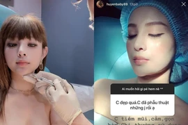 Bị chê "mặt nhựa" do tiêm botox, Huyền Baby phản ứng cực căng