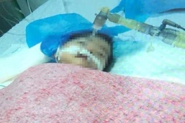 Chủ tịch Hà Nội yêu cầu Công an điều tra vụ bé 8 tháng tuổi tử vong do bị tiêm nhầm