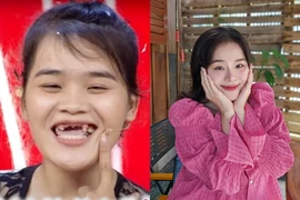 "Thánh sún" Ngân Thảo ra sao sau 6 năm nổi tiếng?