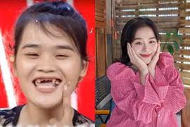 "Thánh sún" Ngân Thảo ra sao sau 6 năm nổi tiếng?