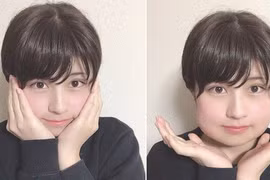 Mặt biến dạng vì mọc răng khôn, hot girl Nhật Bản vẫn gây sốt mạng