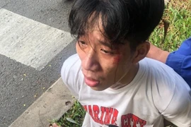 Video: Tài xế xe buýt kể lúc bị nam thanh niên kề dao vào cổ