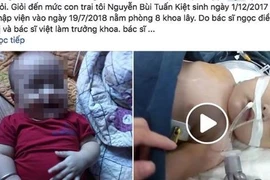 Nghệ An: Bé 7 tháng tuổi tử vong sau nhiều ngày nằm viện mà không ra bệnh
