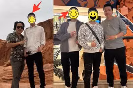 Khoa Pug tự tay đăng ảnh trước và sau khi kéo chân 5 tỷ