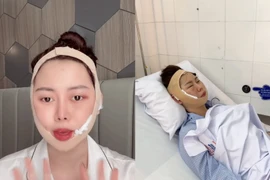 "Chị Google" Việt Phương Thoa biến chứng thẩm mỹ sau 6 năm