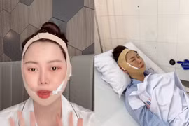 "Chị Google" Việt Phương Thoa biến chứng thẩm mỹ sau 6 năm