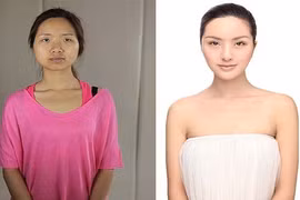 Bố tham ô tiền tỷ giúp con gái trùng tu nhan sắc