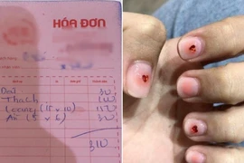 Làm nail hình trái tim, cô gái ngã ngửa khi nhìn hóa đơn